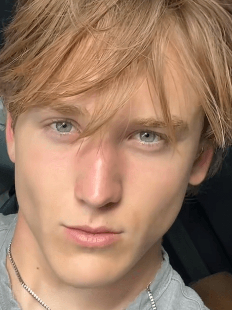 Jordan Wood side profile after — maxilla forward, head posture corrected, visibly stronger jawline and midface projection