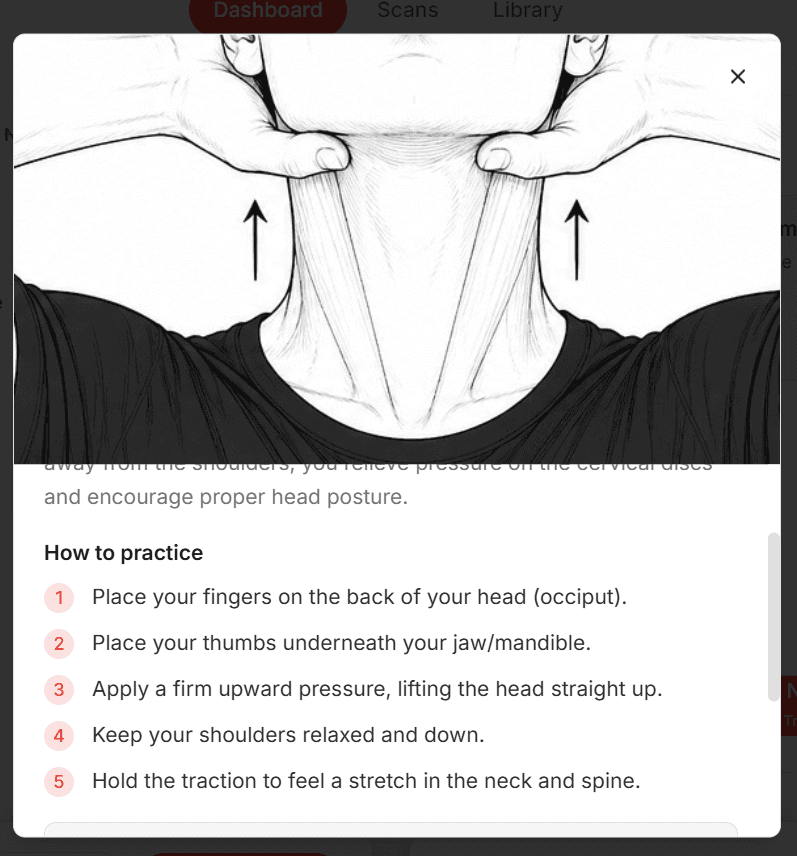 Illustrated neck-traction technique: hands cupping the back of the head with thumbs under the jaw, lifting straight up to decompress the cervical spine and reposition the atlas